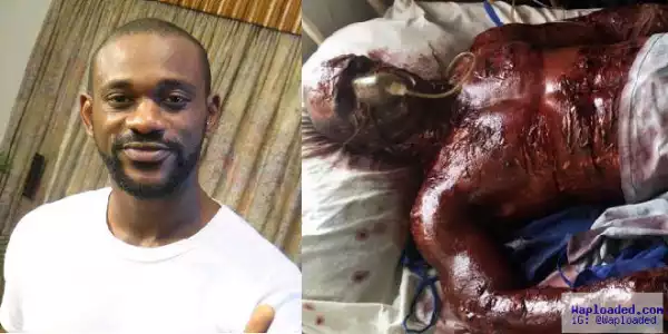 Nollywood Director That Burnt Actor On Set Explains Why He Fooled The World (VIDEO)